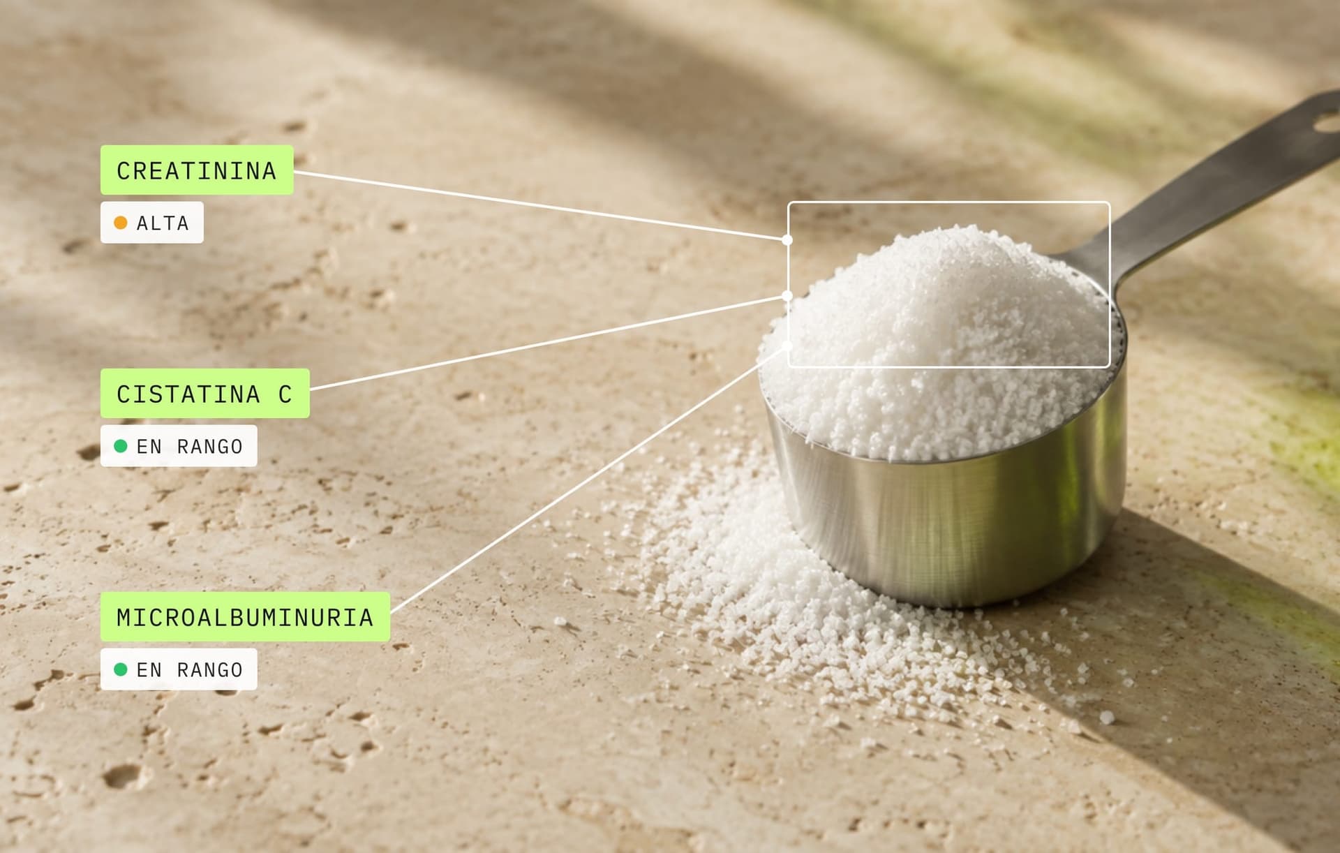 Creatina en una cuchara medidora con etiquetas de biomarcadores: creatinina alta, cistatina C y microalbuminuria en rango