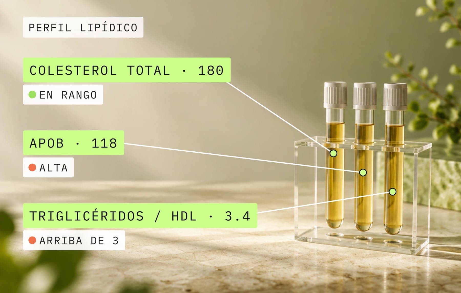 Perfil lipídico: tubos de muestra de sangre con etiquetas de colesterol total en rango, ApoB alta y triglicéridos / HDL arriba de 3