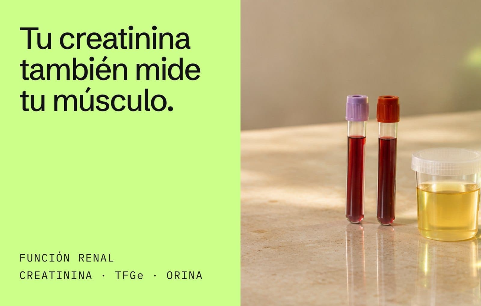 Pruebas de función renal: tu creatinina también mide tu músculo; tubos de sangre y muestra de orina para creatinina, TFGe y orina
